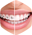 Orthodontic Assisting Course Online